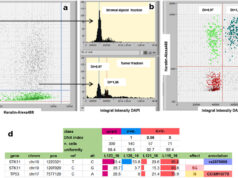 Biopsia digitale: quando le cellule del tumore diventano pixel Biopsia Digitale Az Magazine