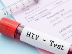 Hiv, test fai da te per la prima volta in Italia